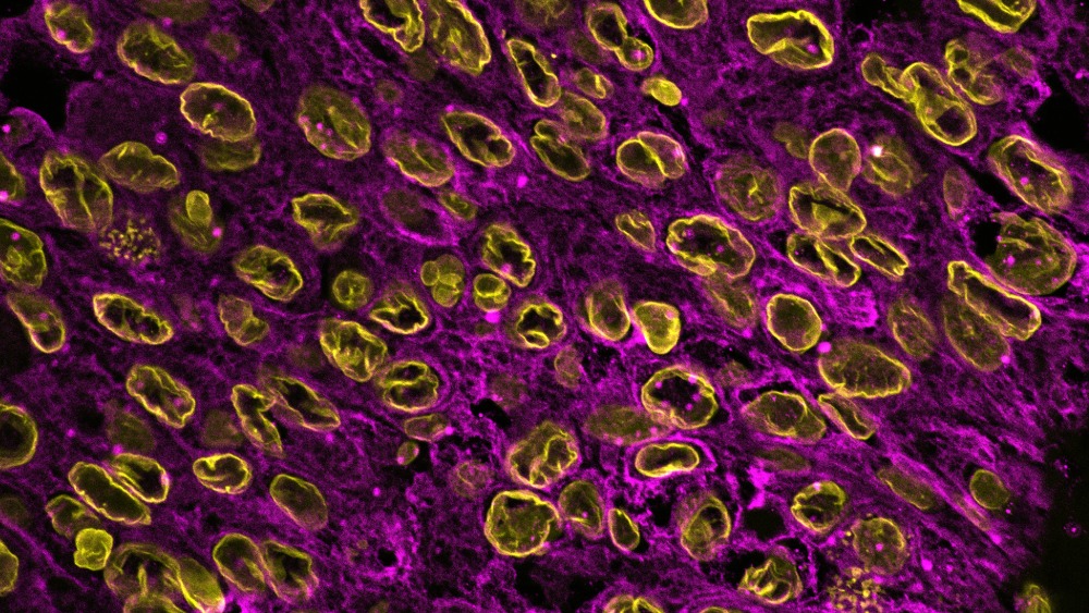 Microscopic image of purple and yellow stained cells