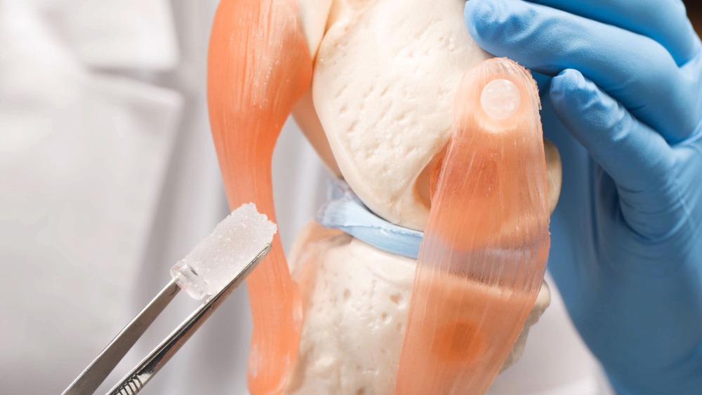 A biomaterial and a knee anatomy model