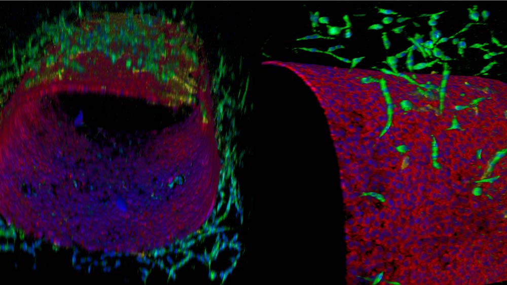 A microscopic view of a lymph organ-on-a-chip. The image shows a cylindrical shape made from small red and blue dots with green tendrils all around it.