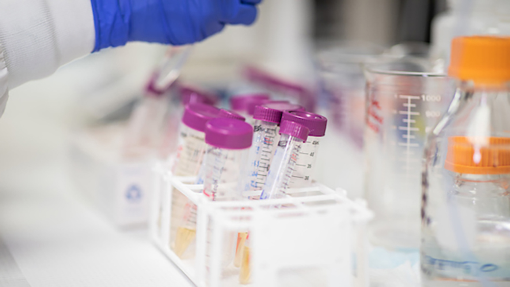 Blue gloved hand holds test tube above multiple test tubes containing yellow liquid with purple caps being held in test tube organizer. 