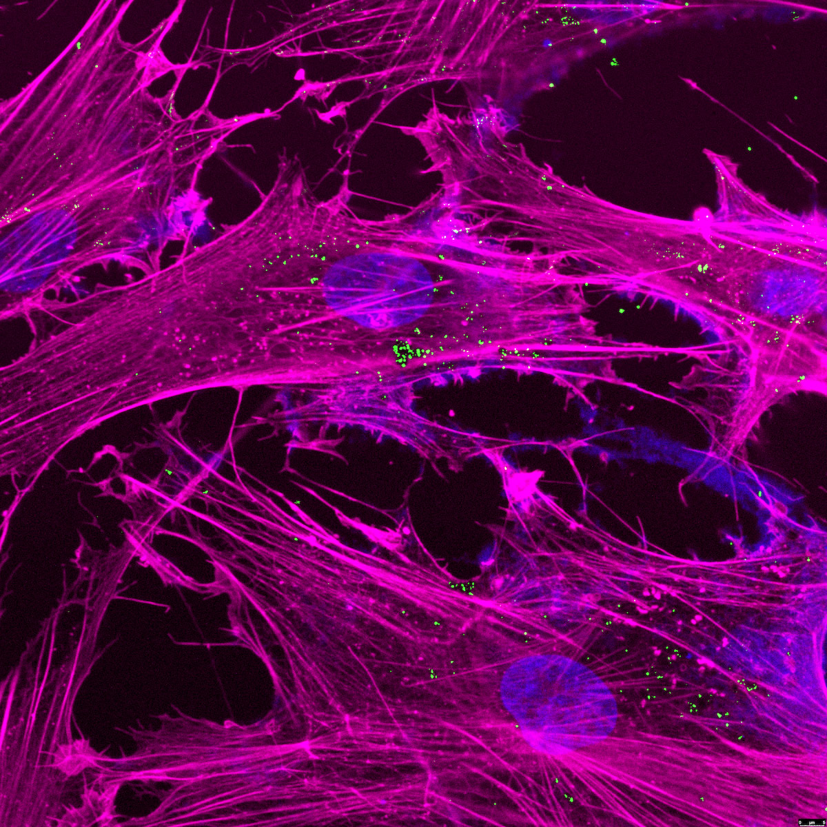 This is a close-up image of green nanoparticles within a purple cytoplasm of a cell and a blue nucleus. 