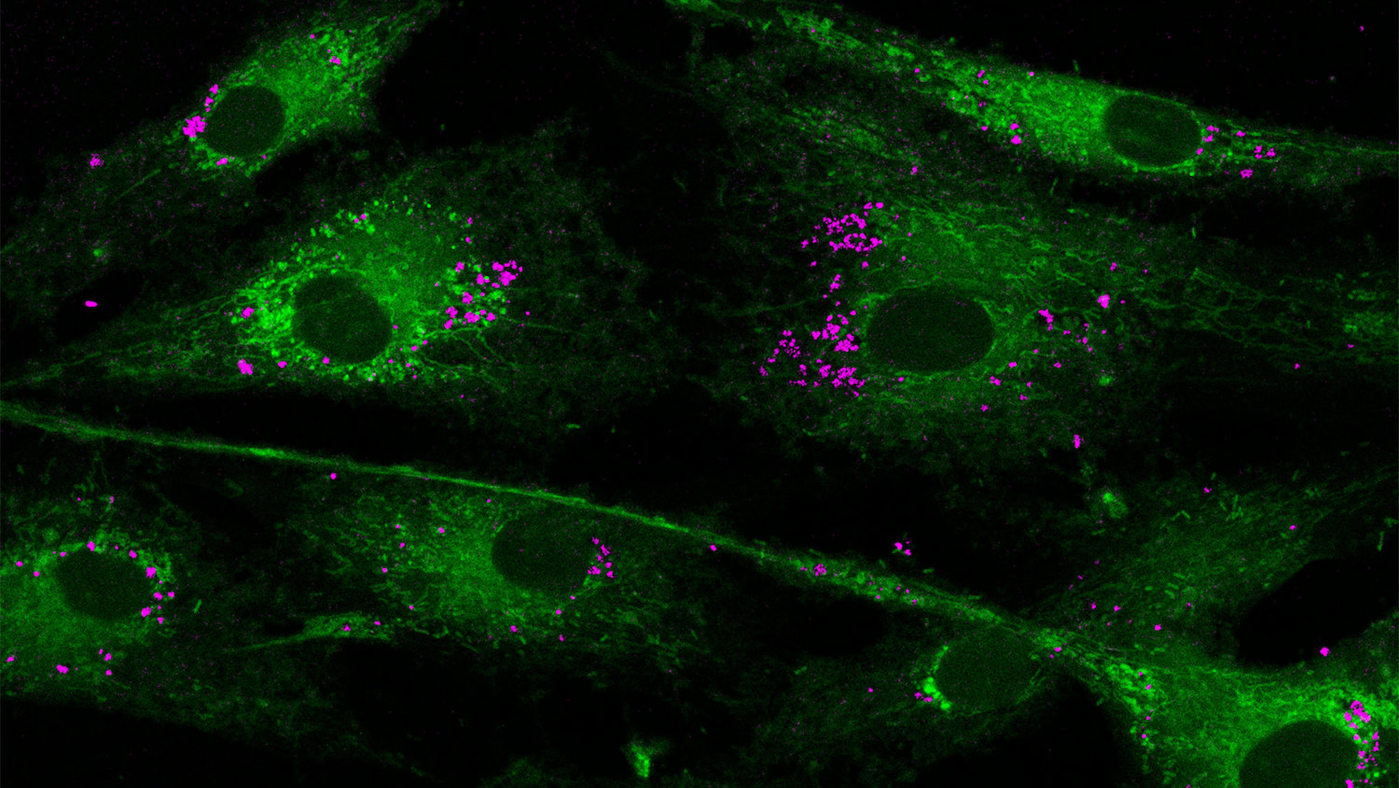  Green matter with a dark green circular center and purple particles sprinkled around the lighter green area. 