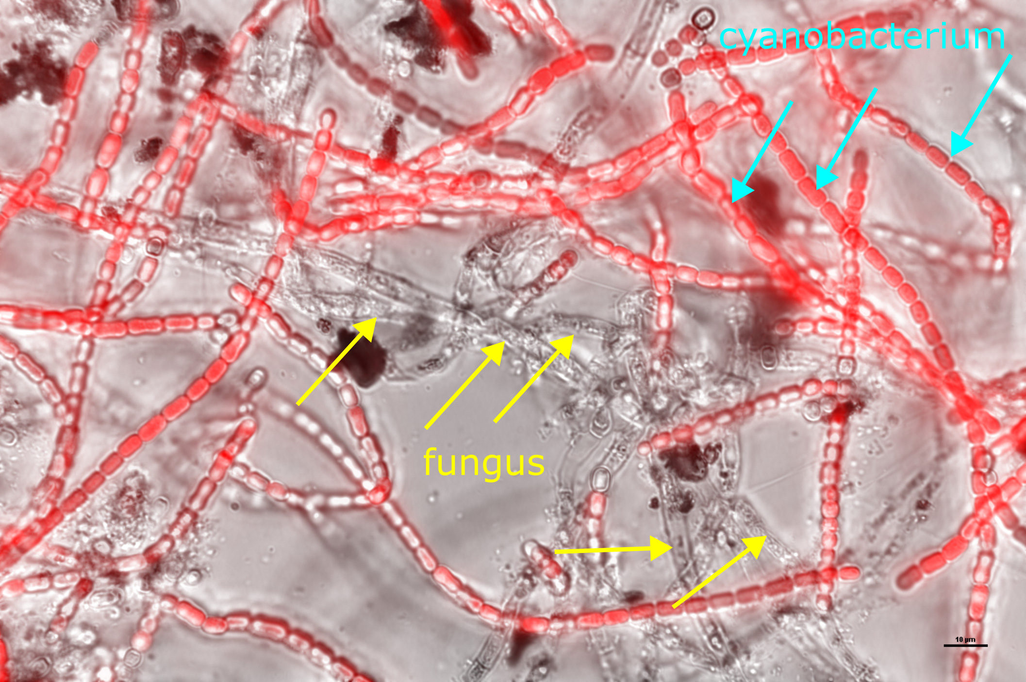 A microscopic view of cyanobacterium and fungus.