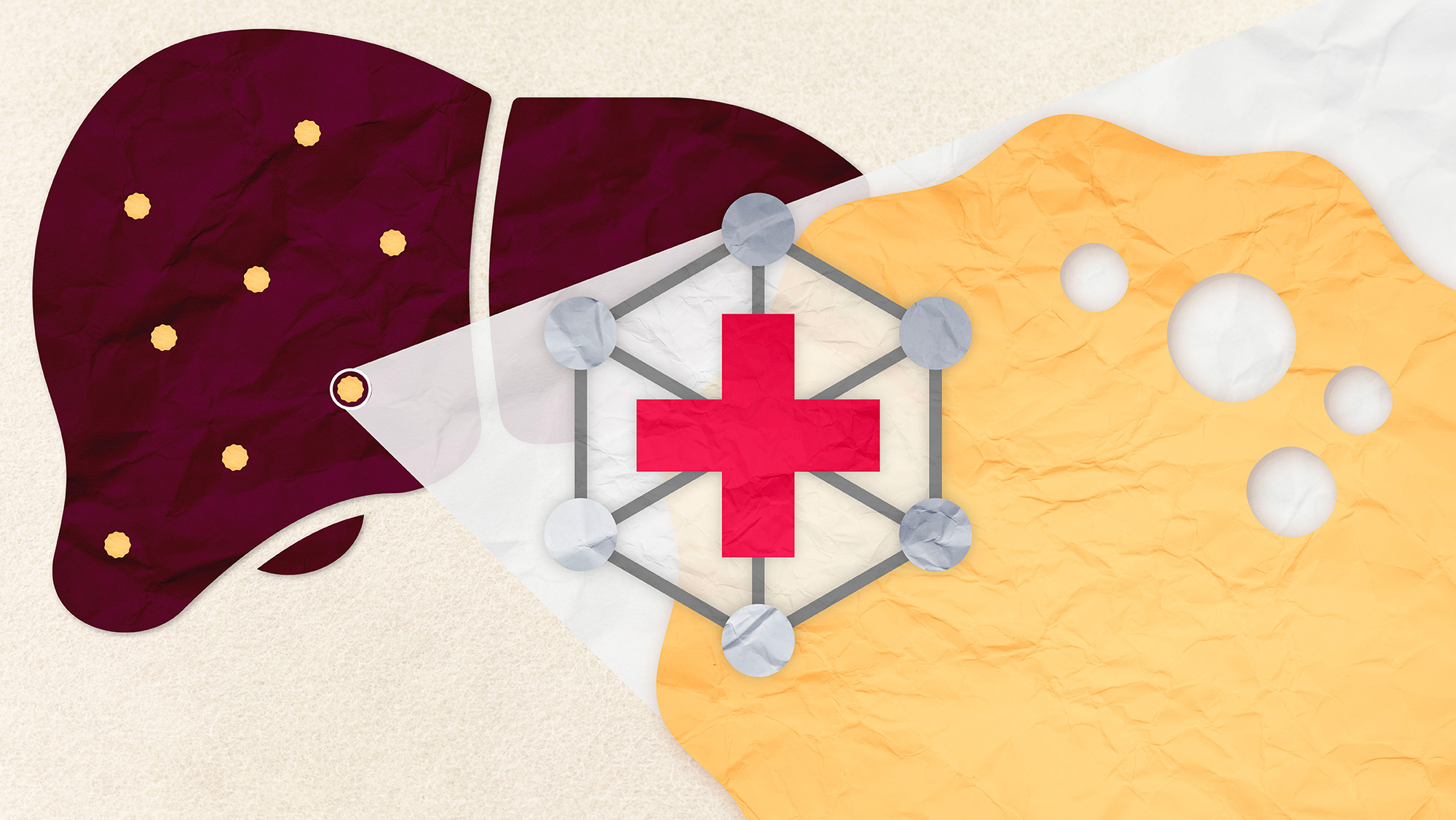 A graphic of a liver highlighting a diseased cell.