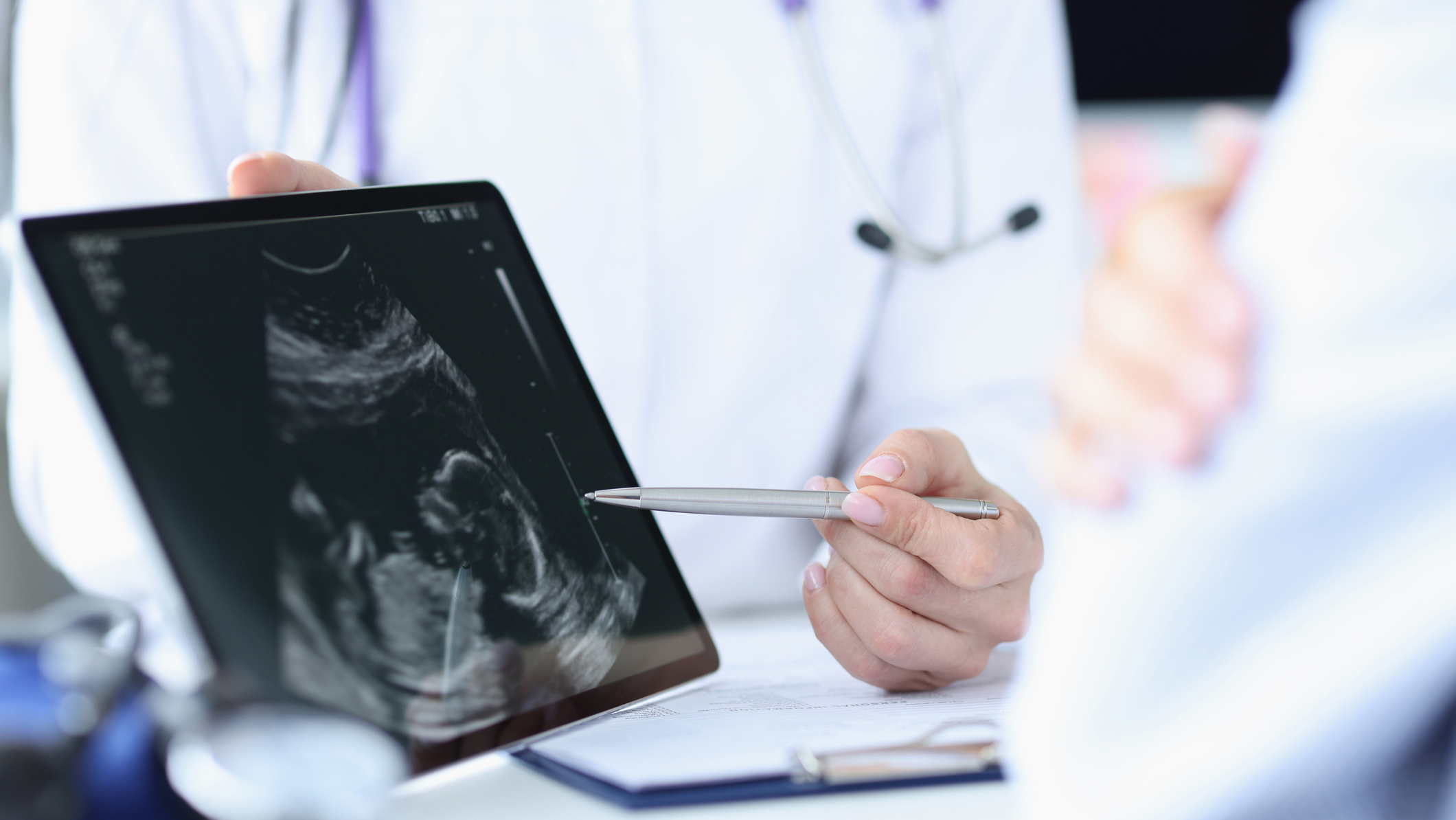 An image of a doctor pointing at an ultrasound on a tablet.