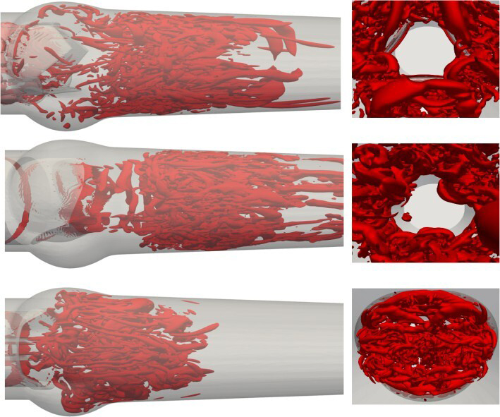 Blood flow visualizations for three different replacement valves.